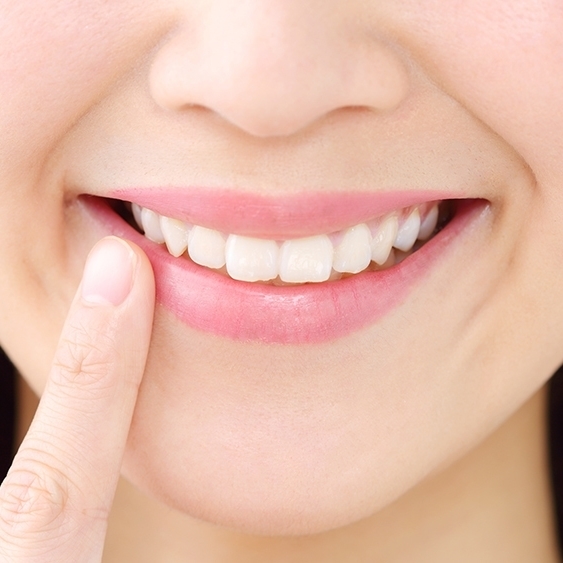 矯正歯科を終えて笑顔になった患者の口元