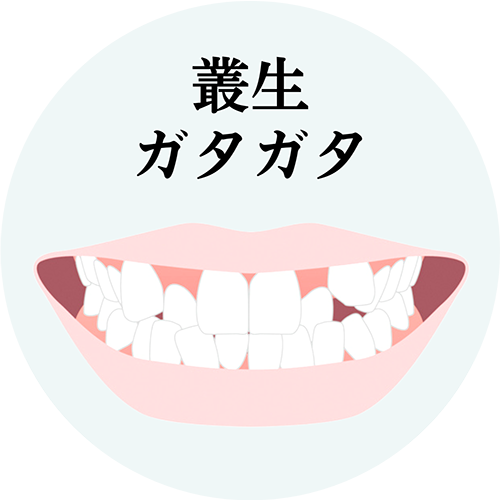 叢生の治療について解説したページへのリンク