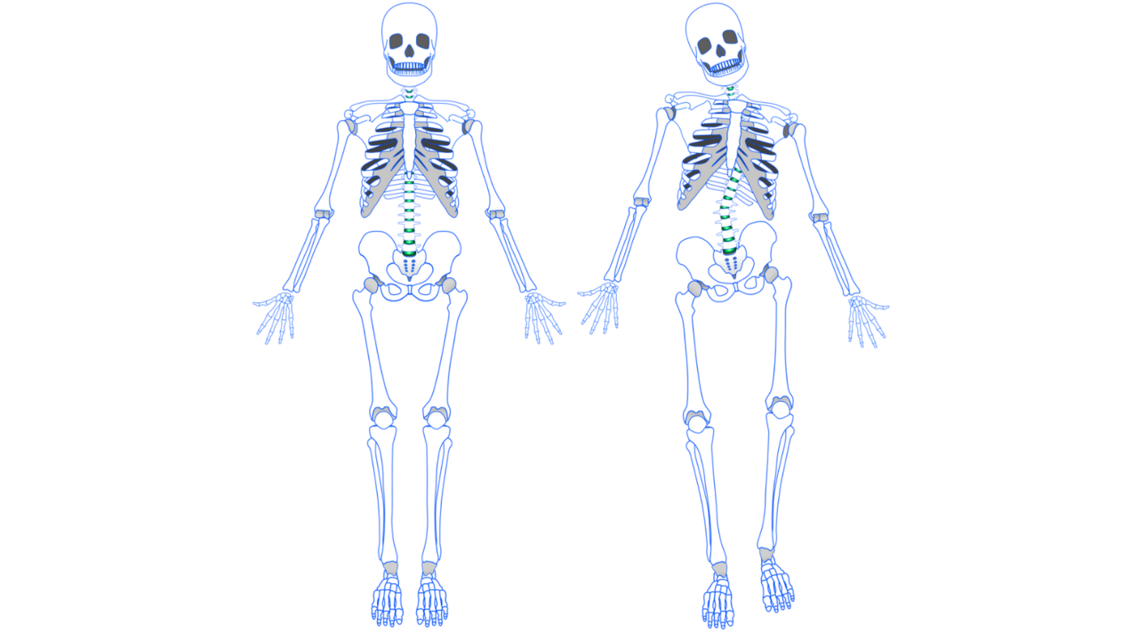 噛み合わせのズレが身体全体の歪みを発生させるイメージ画像