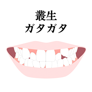 叢生の治療について解説したページへのリンク