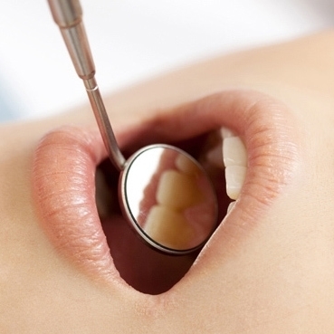 定期通院で歯の動きをチェックする様子