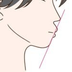 矯正に失敗して口ゴボになる理由について解説したページへのリンク