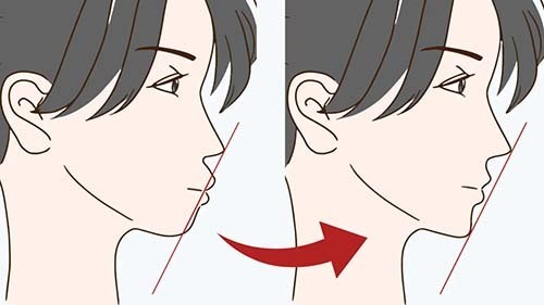 美しい顔立ちを取り戻せる矯正治療について解説したページへのリンク