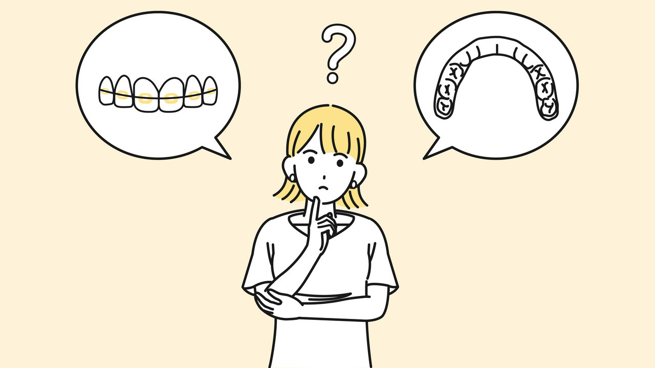 インビザラインとワイヤーどっちにするか迷っている女性のイラスト