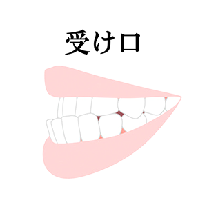 受け口治療について解説したページへのリンク