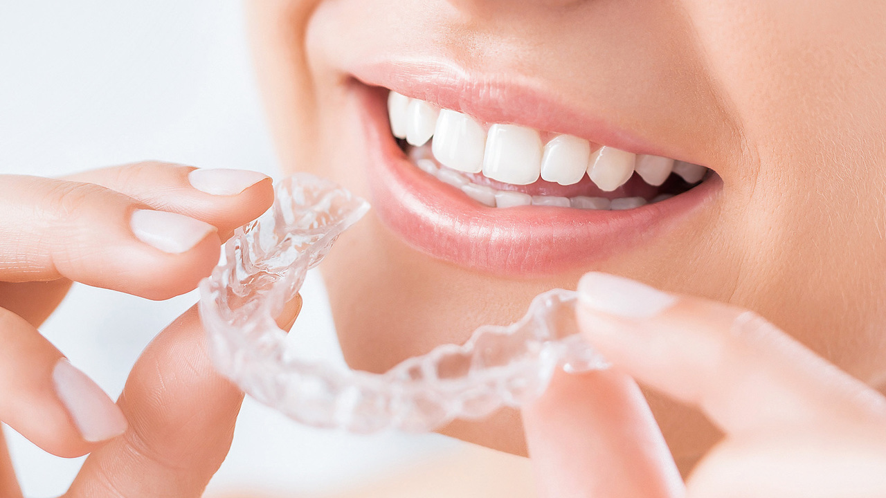 透明なマウスピース矯正装置を装着した女性が自然な笑顔を見せている様子