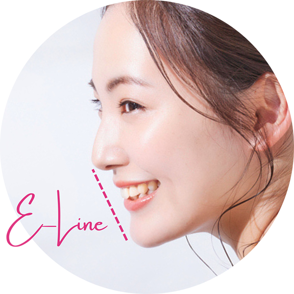 Eラインの場所を解説した画像